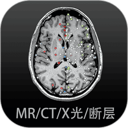 [流言板]圣诞冠军！阿森纳1